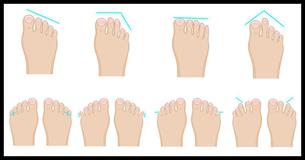 La Forma De Tus Pies Puede Revelar Algo Fascinante Sobre Tu Personalidad