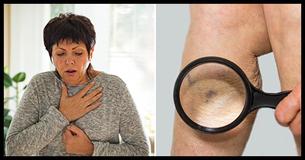 10 formas de identificar pronto un coágulo de sangre