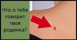 Что твоя родинка рассказывает о том, как тебя убили в прошлой жизни?