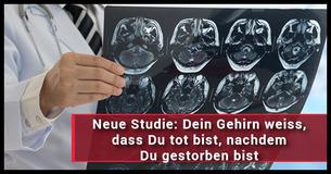 Erschreckende Studie zeigt, dass unsere Gehirne sich selbst bewusst sind, nachdem wir gestorben sind