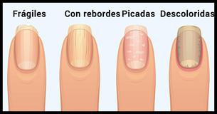 ¡La sorprendente verdad sobre lo que tus uñas revelan sobre tu salud 