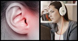Doctors Warn If You Don't Want Ear Blackheads, Limit Your Usage Of Headphones
