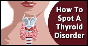 All You Need To Know About Spotting, Diagnosing, And Treating Thyroid Disorders