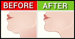 7 Effective Exercises To Reduce A Double Chin And Look Younger