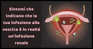 7 importanti sintomi che indicano che la tua infezione alla vescica è in realtà un'infezione renale
