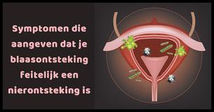 7 belangrijke symptomen die betekenen dat jouw blaasontsteking feitelijk een nierontsteking is