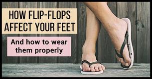 8 Surprising Reasons To Avoid Flip-Flops And 6 Tips On How To Wear Them Safely