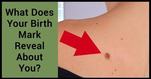 What Does Your Birth Mark Reveal About How You Were Killed In Your Past Life?