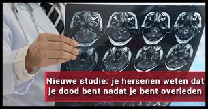 Angstaanjagend onderzoek onthult dat onze hersens nog werken nadat we zijn gestorven