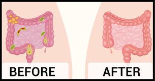 Feeling Bloated? These 2 Ingredients Will Flush You Out 