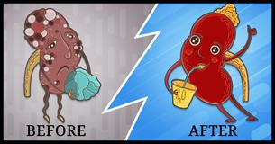 Naturally Flush Kidney Stones With These Four Ingredients