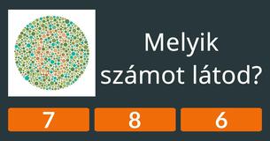 Tényleg olyan jól látsz, mint ahogyan gondolod?